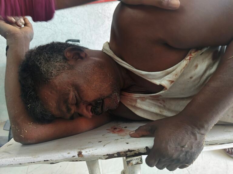 अज्ञात वाहन की टक्कर से अधेड़ जख्मी,रेफर