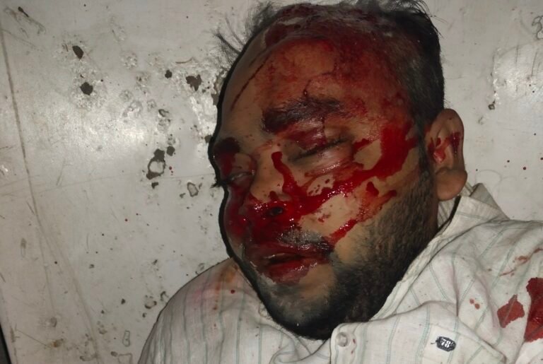 अनियंत्रित बाइक हवा में उड़ी गिरने के बाद तीनो जख्मी दो की हालत गंभीर