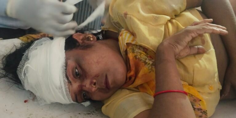 बाइक से गिरकर महिला गिरकर घायल,रेफर