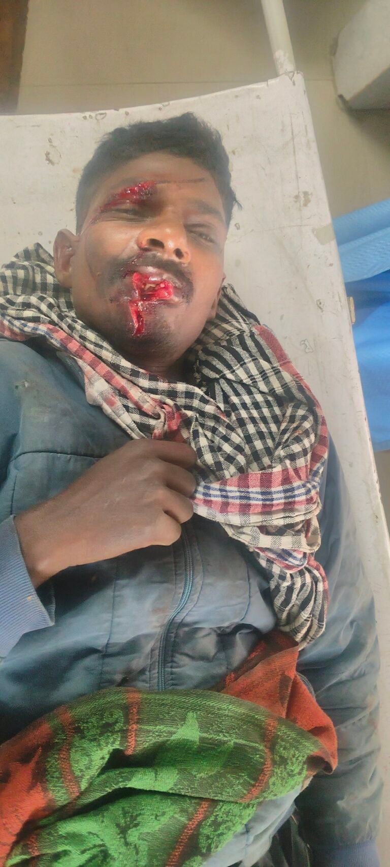 स्कूली वाहन के टक्कर से बाइक सवार घायल,रेफर