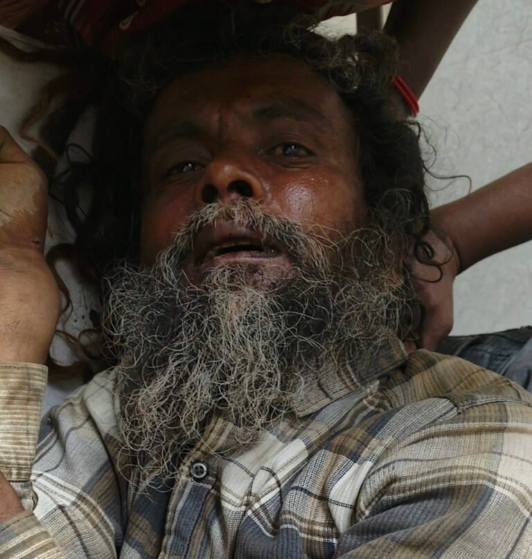 बाइक अनियंत्रित होने से बाइक सवार व राहगीर घायल
